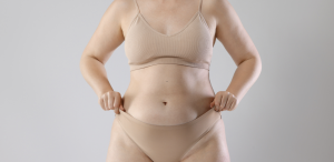 Average Liposuction Surgery Prices in McLean VA